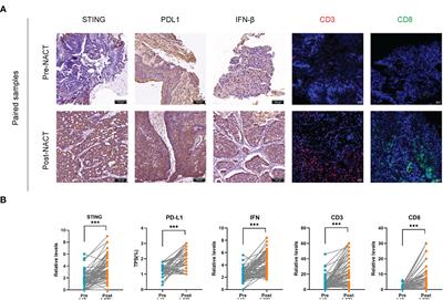 Platinum-based neoadjuvant chemotherapy upregulates STING/IFN pathway expression and promotes TILs infiltration in NSCLC